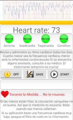 Diagnóstico cardíaco(arritmia) 2