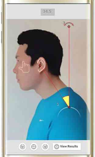 Forward Head Posture (FHP) 3