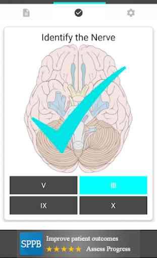 Cranial Nerves Flashcards 4