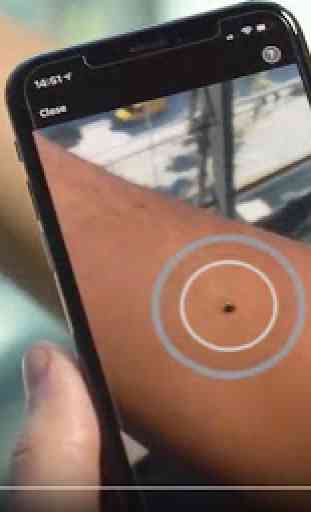 SkinVision - Detect Skin Cancer. Track your Moles. 1