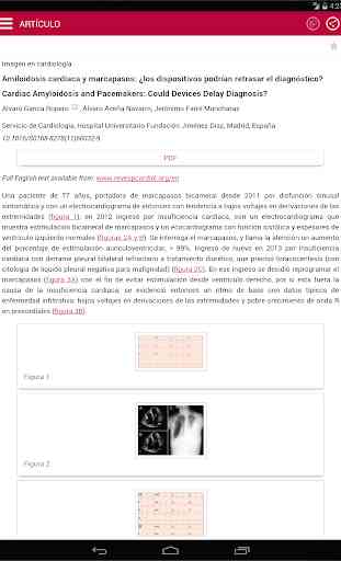 Revista Española Cardiología 4