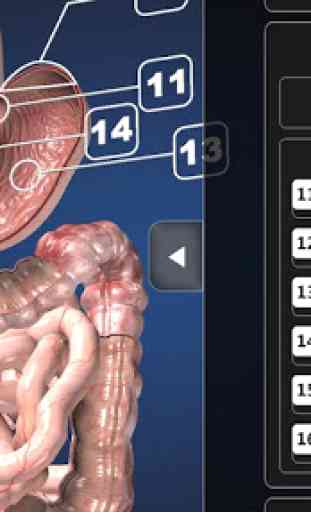 Endoscopy 3D 3