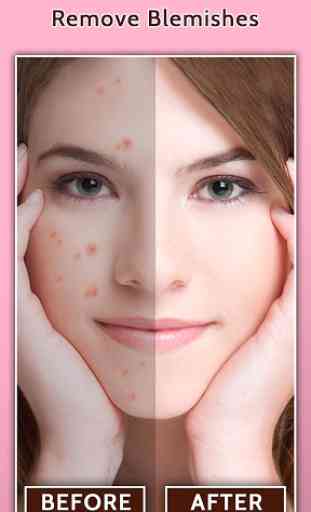 Eliminador de manchas en la cara: piel suave 1