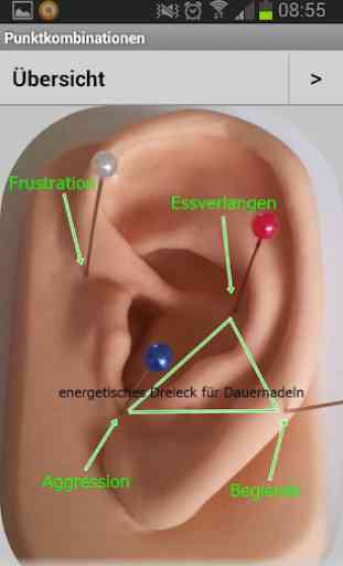 Ohr Akupunktur 3