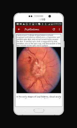 Ophthalmology Guide 3