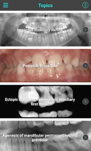 Interceptive Orthodontics 2