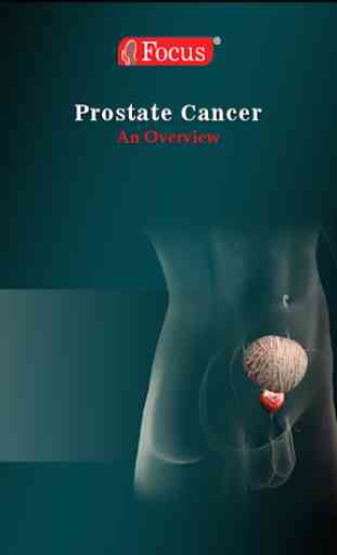 Prostate cancer 1