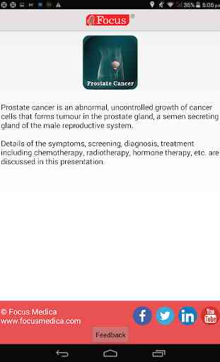 Prostate cancer 3