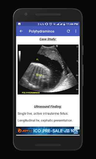 Obstetrics & Gyenacology Ultrasound Guide 4