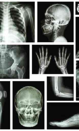 musculoskeletal x-ray interpretation GUIDE 2