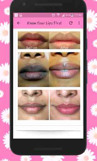 How To Get Soft Pink Lips Naturally - Lip Care 2