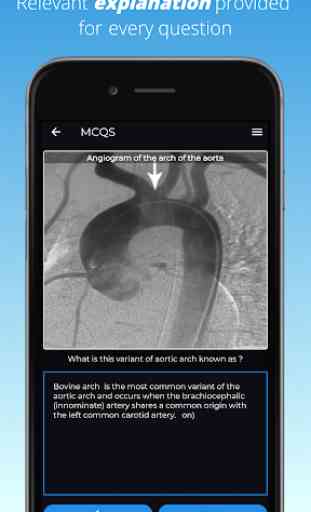 FRCR Radiological Anatomy Flashcards & MCQs 4