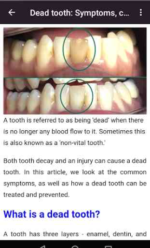 Todas las enfermedades dentales 4