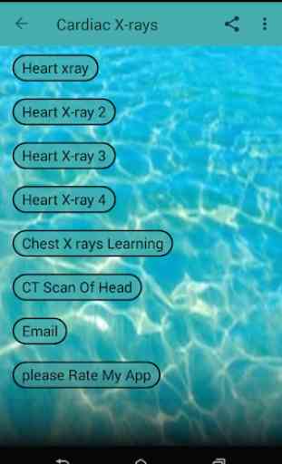 Cardiac X-rays 1