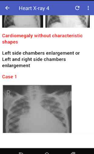 Cardiac X-rays 3