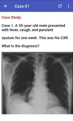 Chest X-Ray Based Cases 3