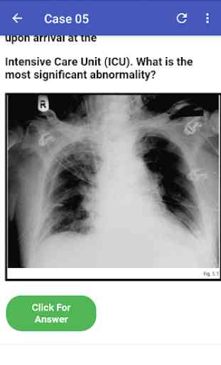 Chest X-Ray Based Cases 4