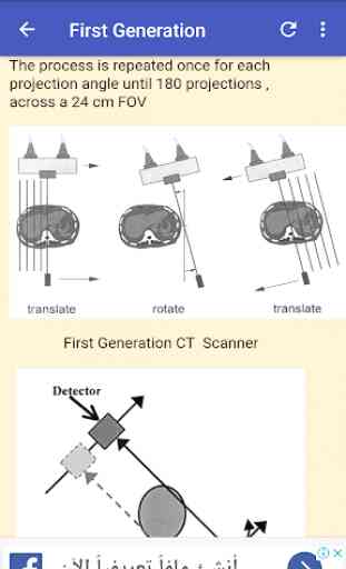 CT Scan Generations 2