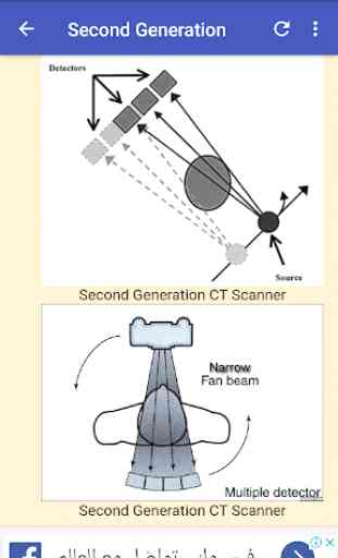 CT Scan Generations 3