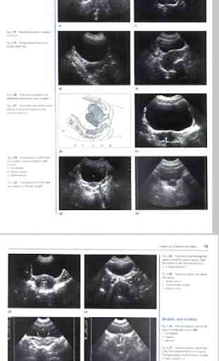 Gynecology - Ultrasound in Obstetrics & Gynecology 4