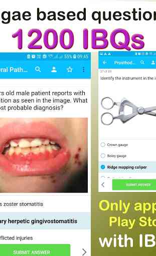 Neet MDS, OFFLINE Dental PG app,15K MCQs,AIIMS MDS 3