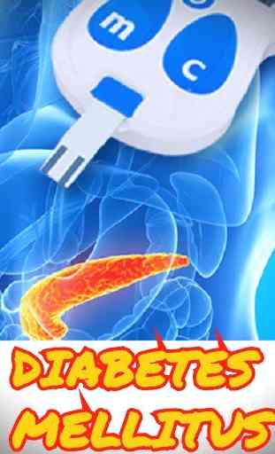 Diabetes Mellitus (DM) 2