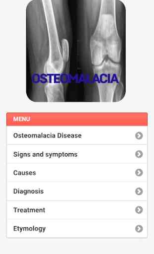Osteomalacia Disease 3