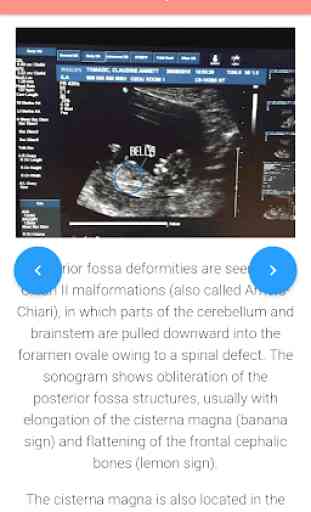A-Z Obstetrics Ultrasound 3