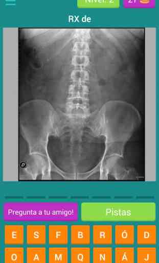 Quiz Radiografias 3
