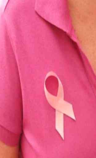 Breast Cancer  (Guide) 2