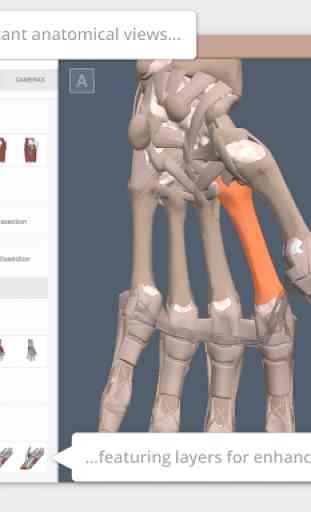 Forearm and Hand: 3D RT - Sub 2