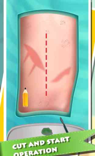 La cirugía de rodilla Simulator - Niños de primeros auxilios Asistente de juego 4