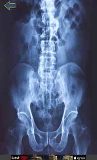 Cuerpo del escáner de rayos X 4
